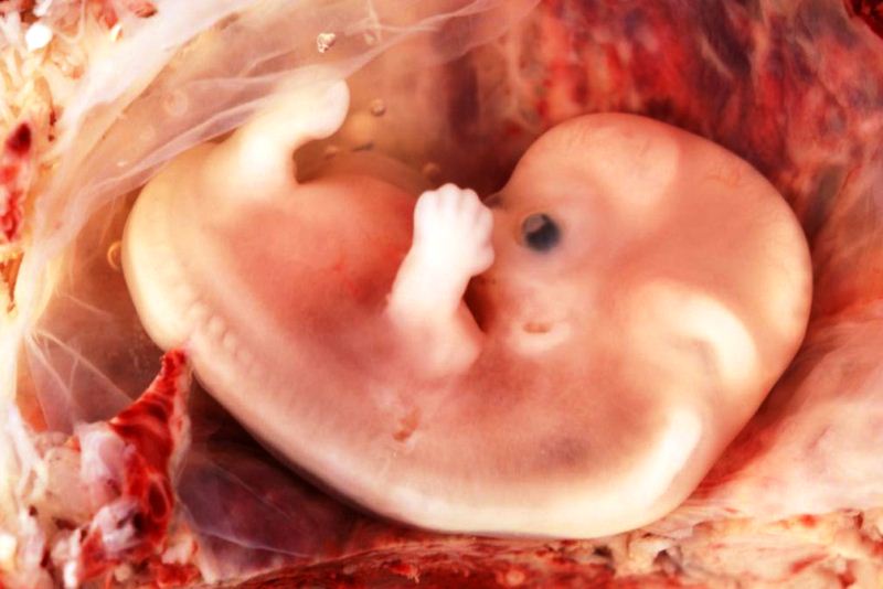 como esta un bebe de tres meses de gestacion